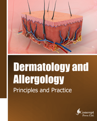 Dermatology and Allergology: Principles and Practice