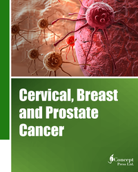 Cervical, Breast and Prostate Cancer