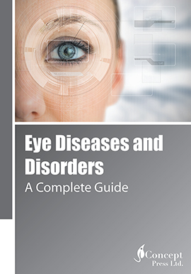 Eye Diseases and Disorders: A Complete Guide